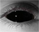  contact lenses