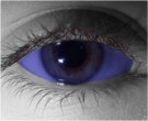  contact lenses