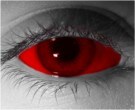  contact lenses