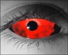  contact lenses