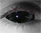  contact lenses