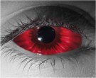  contact lenses