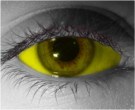  contact lenses