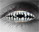  contact lenses