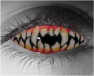  contact lenses